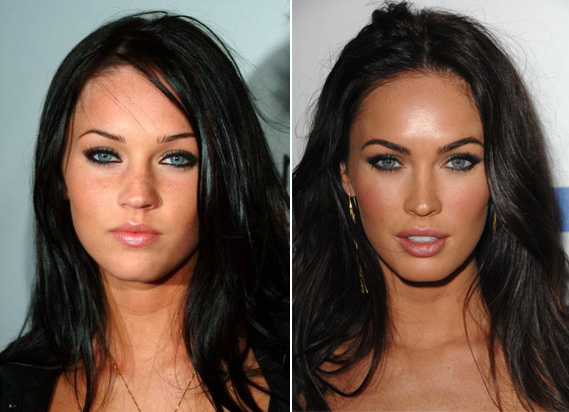 Megan-Fox-before-and-after