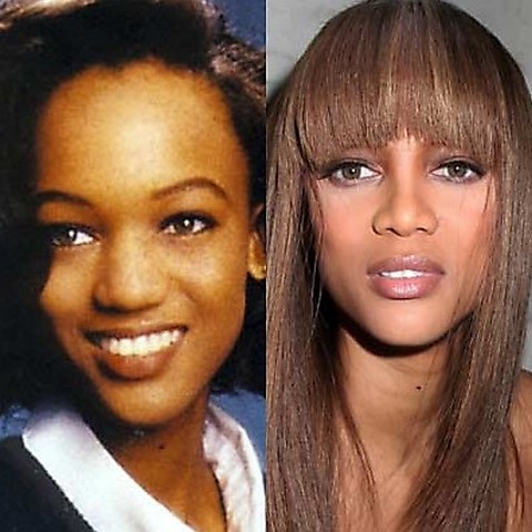 celebrities_plastic_surgery_before_after_17