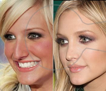 Ashlee-Simpson-Plastic-Surgery-Before-And-After-Nose-Job-Photos