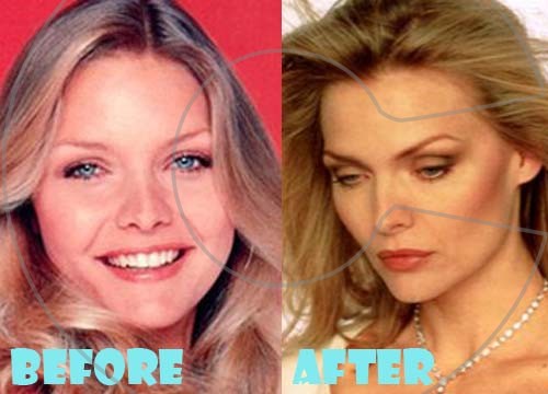 Michelle-Pfeiffer-Plastic-Surgery-Nose-Job