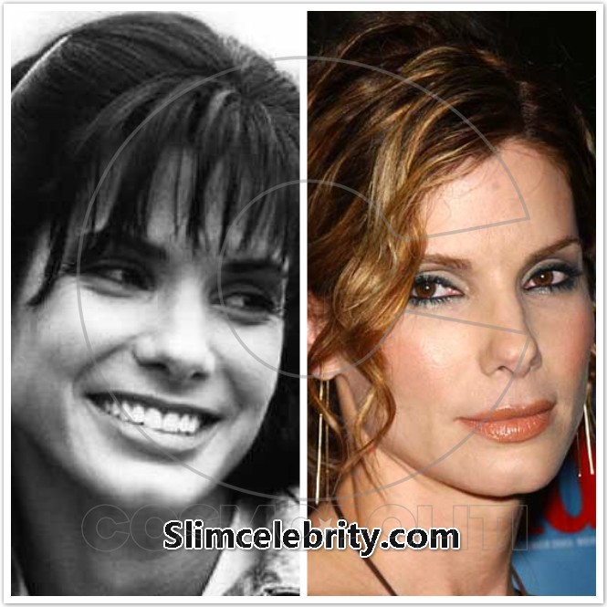 Sandra-Bullock-Plastic-Surgery-Before-and-After-Photos-Botox-Injections-Facelift-and-Nose-Job-7