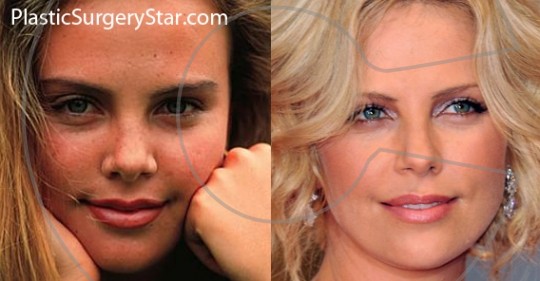 charlize-theron-plastic-surgery-1