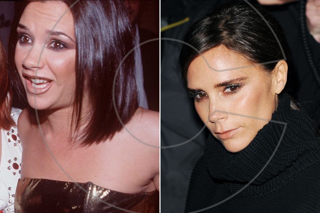 victoria-beckham-nose-job-before-and-after