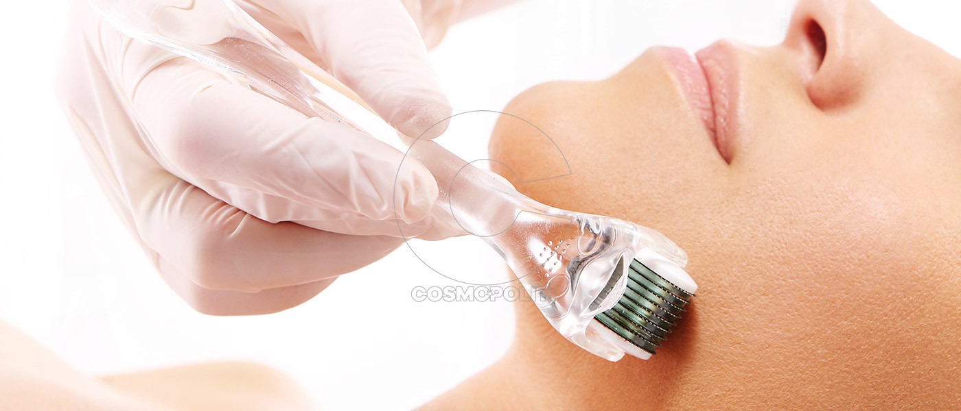 Τι είναι το skin needling και πώς λειτουργεί