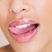 Σκασμένα χείλη: Πώς να παραμείνουν απαλά και ενυδατωμένα
