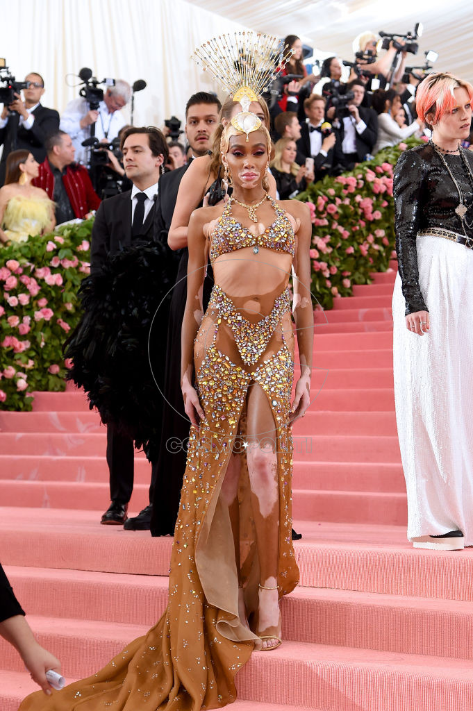NEW YORK, NEW YORK - MAY 06: Winnie Harlow attends The 2019 Met Gala Celebrating Camp: Notes on Fashion at Metropolitan Museum of Art on May 06, 2019 in New York City. (Photo by Jamie McCarthy/Getty Images)