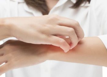 Τι να κάνετε για τα τσιμπήματα από τα κουνούπια